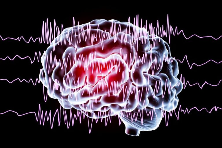 LE CBD POUR L'EPILEPSIE | CBD LOVELY