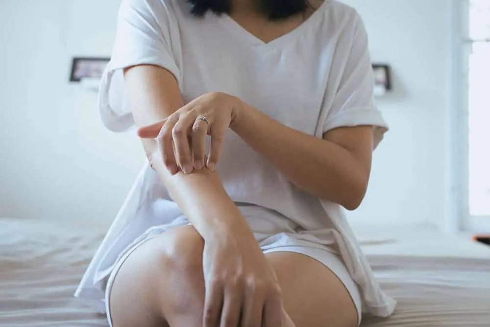 LES BIENFAITS DU CBD POUR LES SYMPTOMES DU PSORIASIS | CBD LOVELY