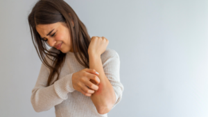 Eczéma Nerveux : Comment le CBD Peut Améliorer Votre Qualité de Vie