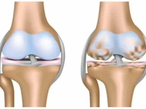 Meilleure mobilité des seniors grâce au CBD