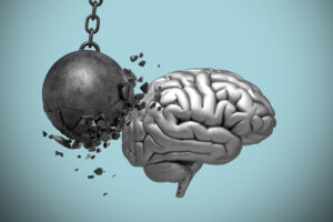 Les causes du stress | CBD LOVELY