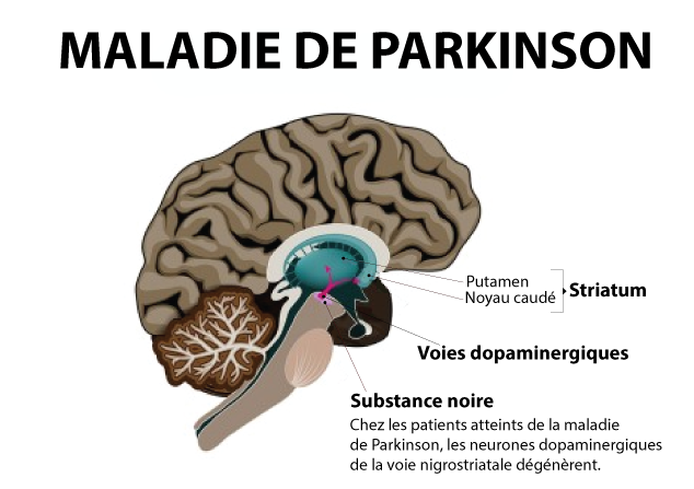 dopamine dans la maladie de parkinson