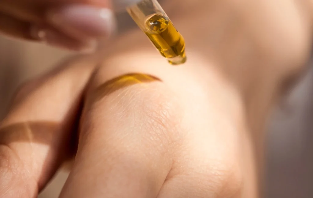 Soulager le psoriasis naturellement | CBD LOVELY