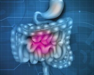 Constipation et bienfaits du cannabidiol (CBD)  CBD LOVELY