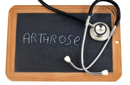 Comment le CBD Peut Soulager la Douleur Arthrose : Guide Complet