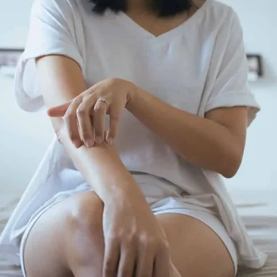 LES BIENFAITS DU CBD POUR LES SYMPTOMES DU PSORIASIS | CBD LOVELY