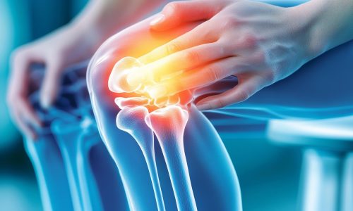 arthrose du genou soulagée par du cbd