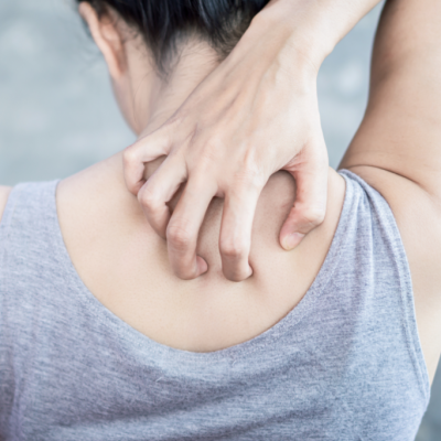 Le psoriasis est-il contagieux ?